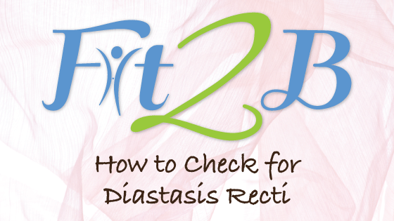 Diastasis recti in an otherwise fit male. Note the diastasis is not