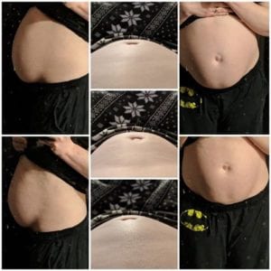 DR Research - fit2b.com - Diastasis Recti Research Collage, Researching Diastasis Rectus Abdominis: Please take our survey to help us learn more about abdominal separation.