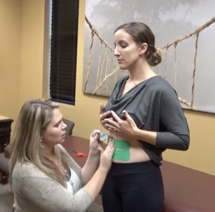 Taping for diastasis recti: criss cross method